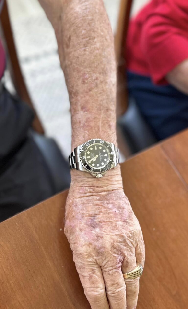 2024 06 17 Grandpa Watch 2